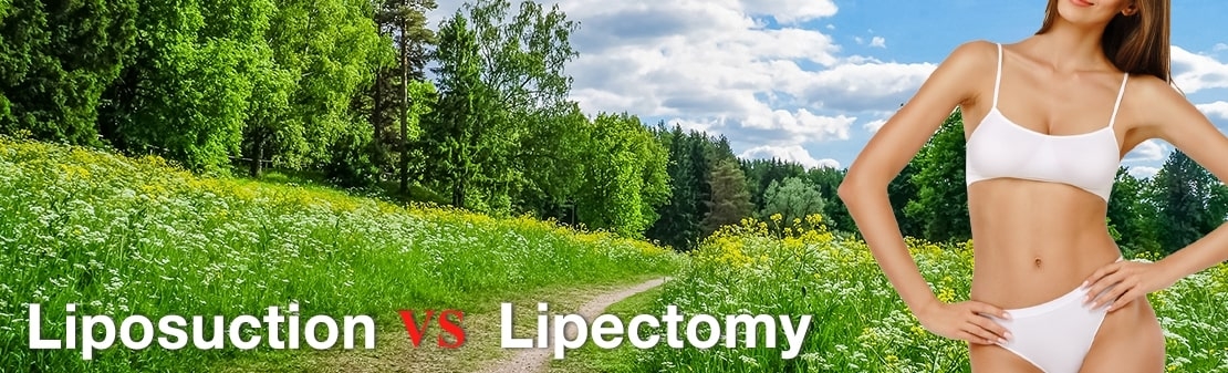 Liposuction vs Lipectomy