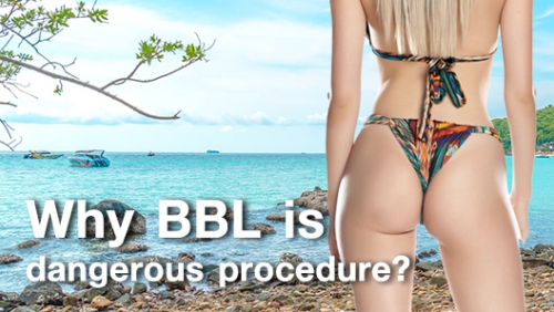 Is a BBL a Dangerous Procedure? How Innovations and AirSculpt Make
