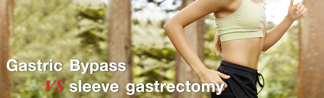 Sleeve gastrectomy vs Gastric bypass