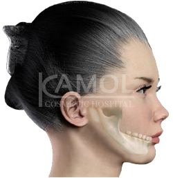 before_and_after_surgery_jaw_augmentation