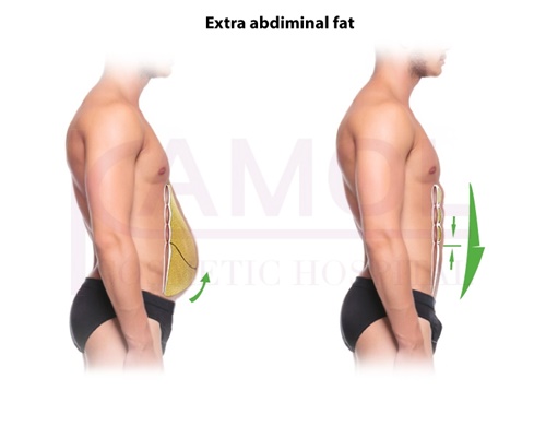 The_area_of_subcutaneous_fat_and_six_pack_creation