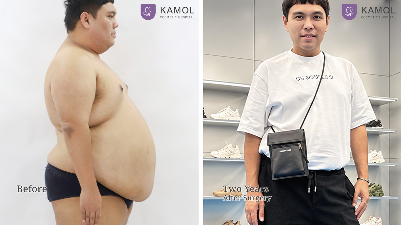 Bariatric / Metabolic / Weight Loss Surgery in Bangkok, Thailand 4 WhatsApp Image 2026 10 06 at 18.18.53